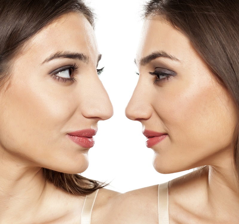Plastic Surgery The Woodlands Tx